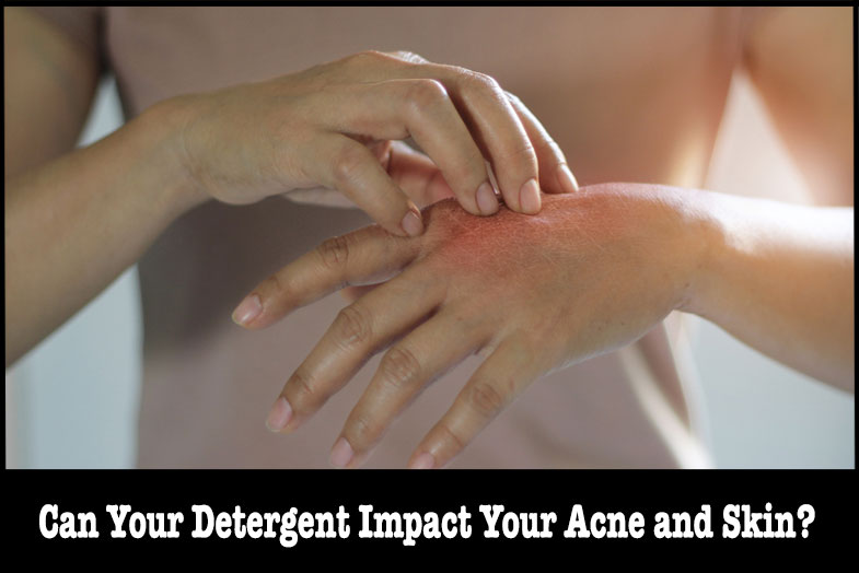 detergent impact your acne and skin